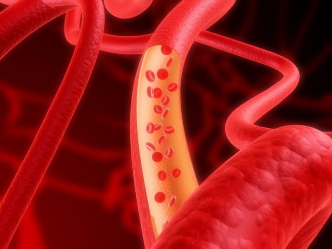 Hvad skal man gøre med arteriosklerose af blodkar